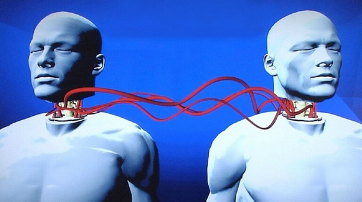 'أعلن عنه عالم يمني'.. ما إمكانية تحقيق مشروع جديد لزراعة الرأس؟