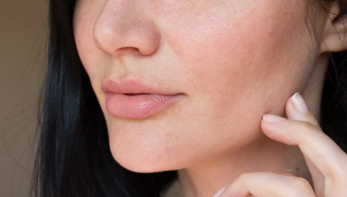 هل تعانين جفاف البشرة في الربيع؟... إليك الحلول