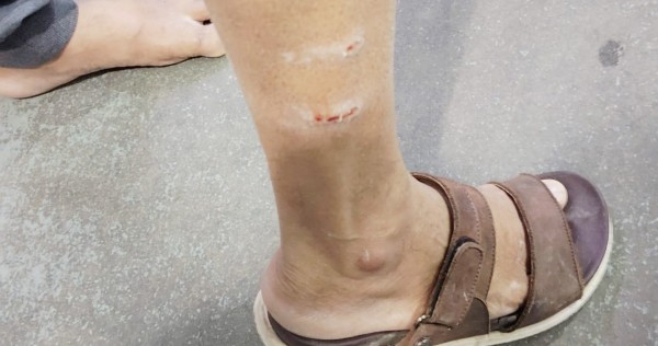 المشي... محفوف بـ "الكلاب"! #الكويت 