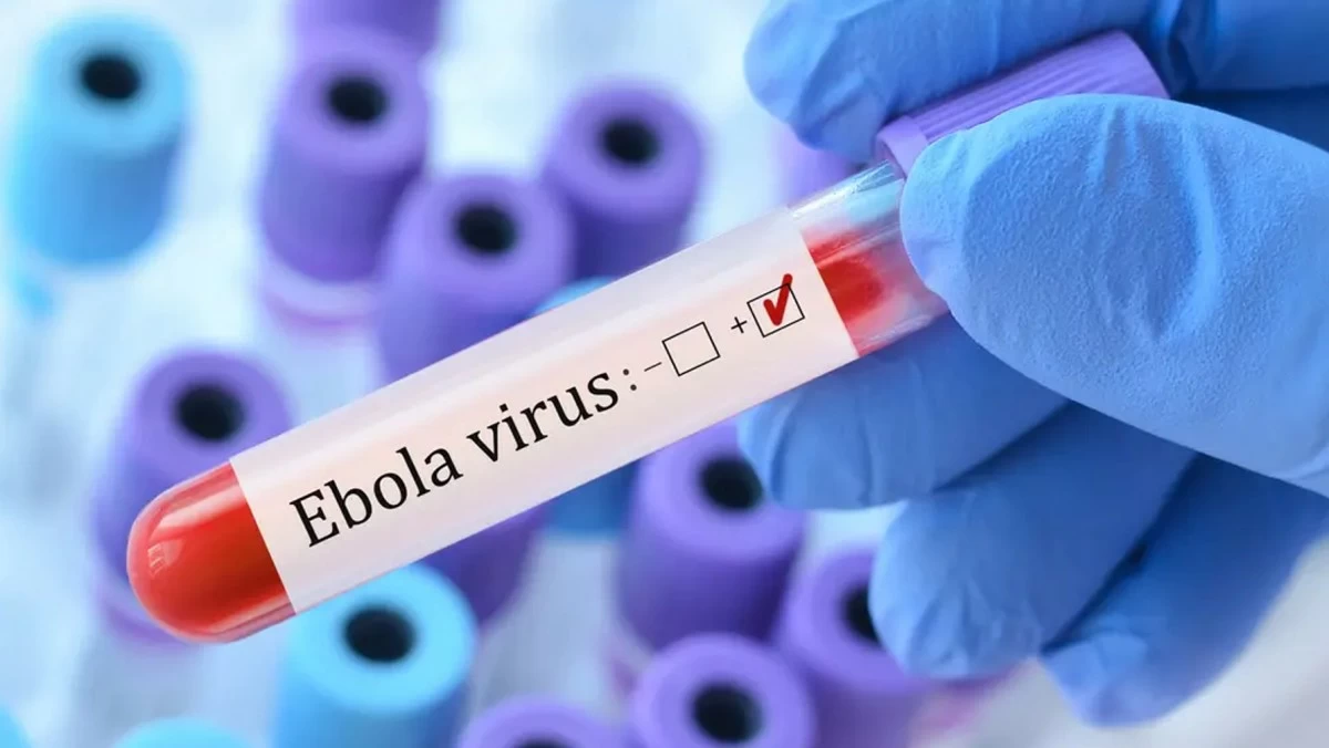 الولايات المتحدة تفرض قيود سفر وفحوصاً صحية مشددة لمنع دخول فيروس 'إيبولا'