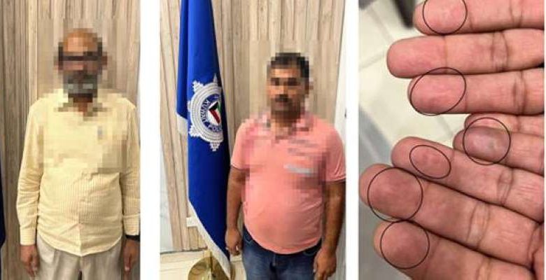 البصمة البيومترية تكشف آسيويين أجريا جراحة لتغيير البصمة