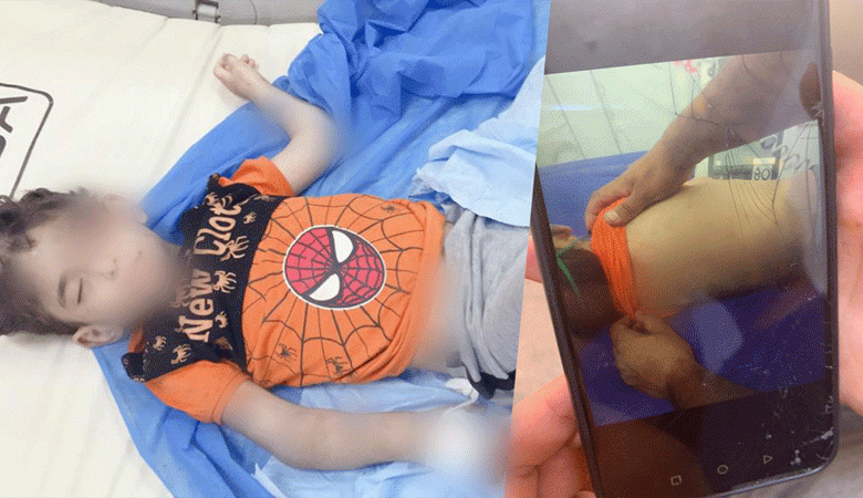 زوجة أبيه كسَّرت عظامه وتركته بين الحياة والموت
