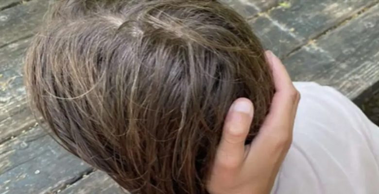 "فتل الرقبة"..تحد قاتل يغزو تيك توك ويثير هلعاً بالمدارس