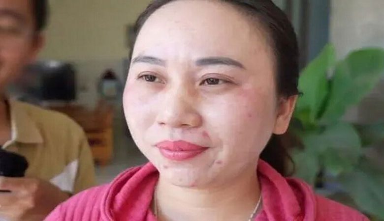 فيتنامية لم تعرف النوم منذ 11 عاماً