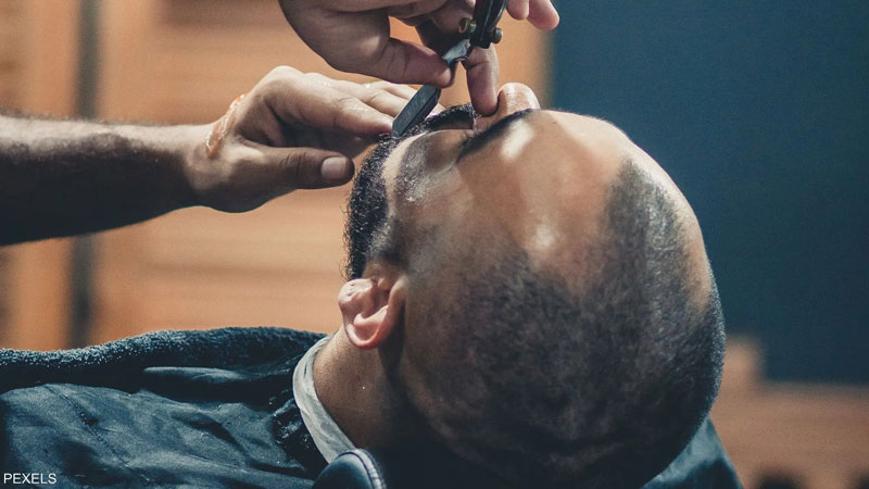 العلماء يكتشفون طريقة مبتكرة لعلاج الصلع