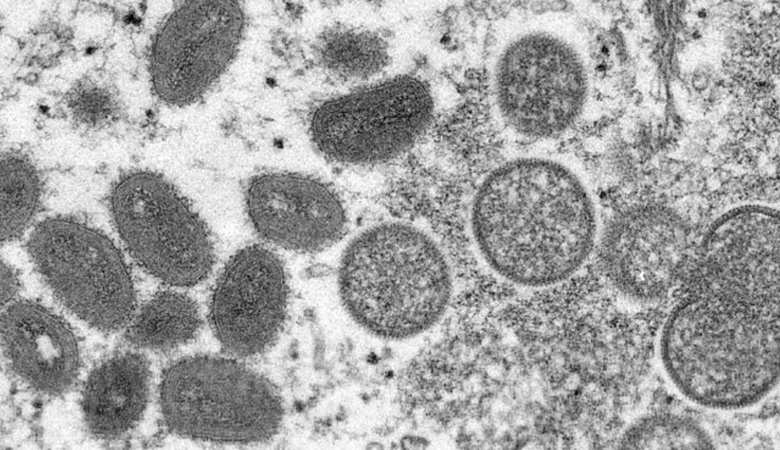 تسجيل أول حالة وفاة بجدري ألاسكا في العالم